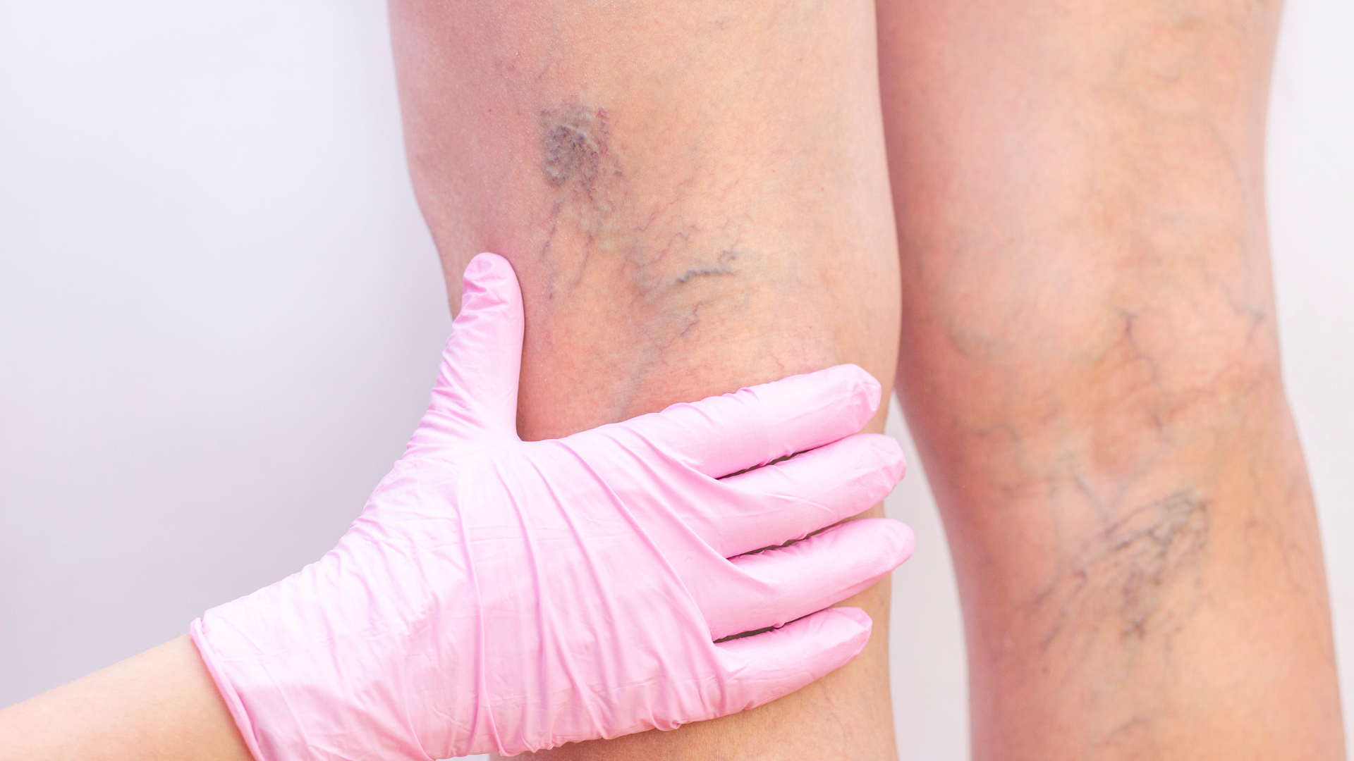 resistencia vascular