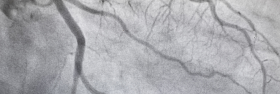 Fase arterial vs. fase venosa
