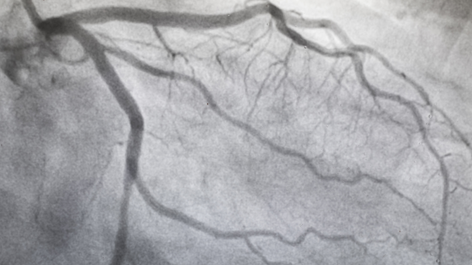 Fase arterial vs. fase venosa